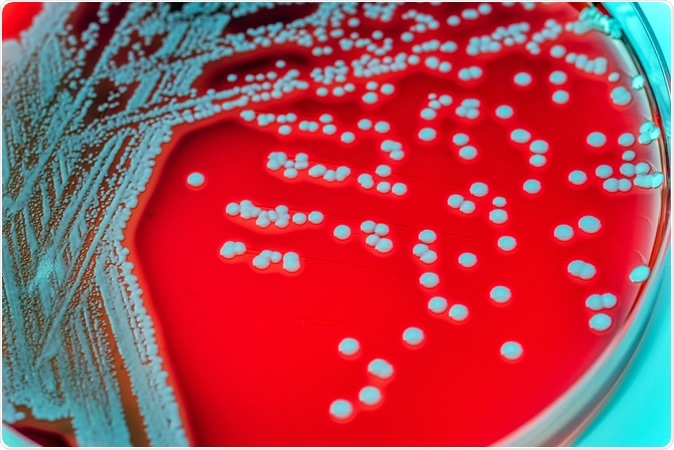 Staphylococcus aureus in a petri dish. Image Credit: Sirirat / Shutterstock