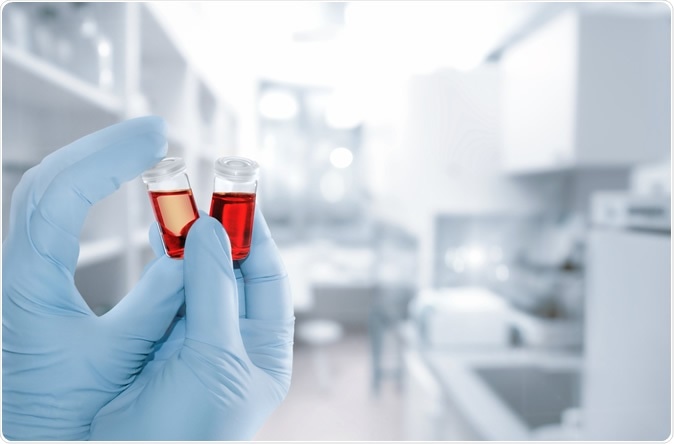 Image Credit: Anyaivanova / Shutterstock Image Credit: Anyaivanova / Shutterstock