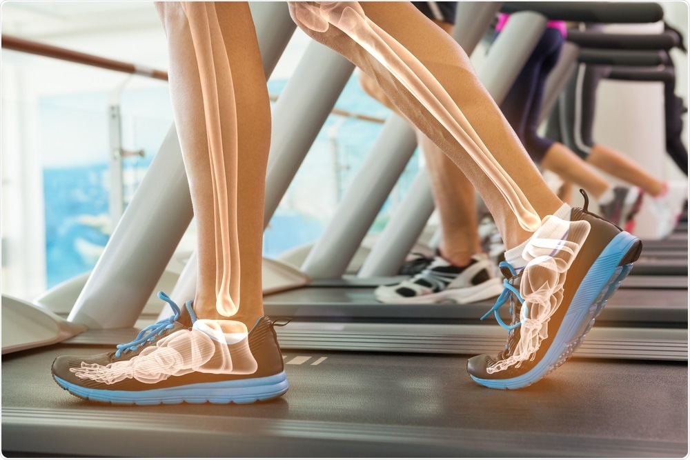 Person running on treadmill showing bone health