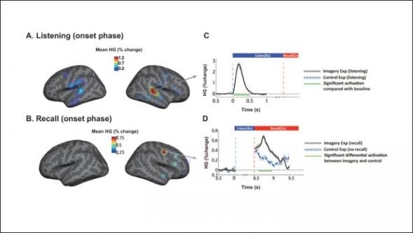 Study provides important insights into music processing by the brain