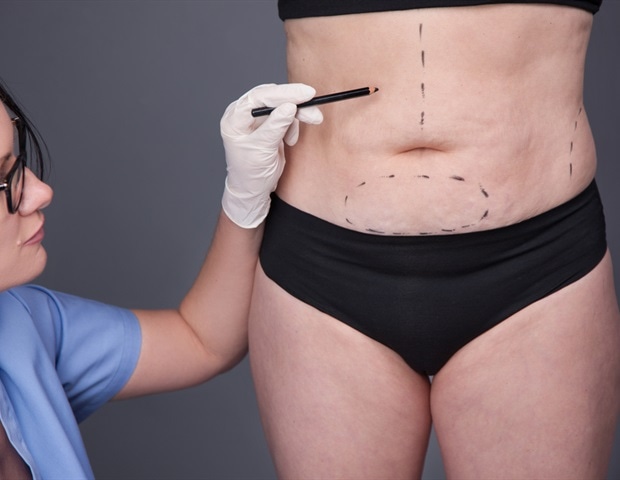 Study: Weight loss surgery can increase risk of colorectal cancer Study: Weight loss surgery can increase risk of colorectal cancer
