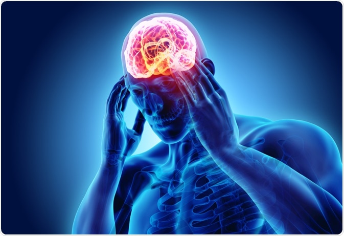 What Foods Can Cause Migraines?