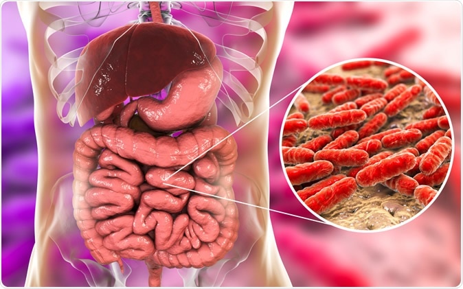 Ulcerative colitis and a missing microbe in the gut