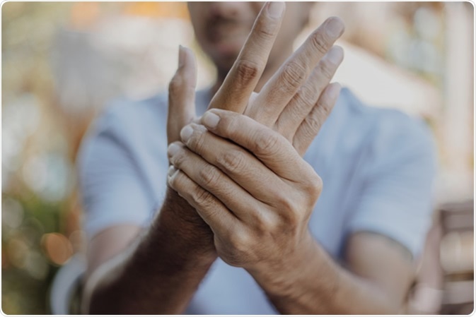 reumatism degenerativ artroza deformantă a mâinilor decât tratarea