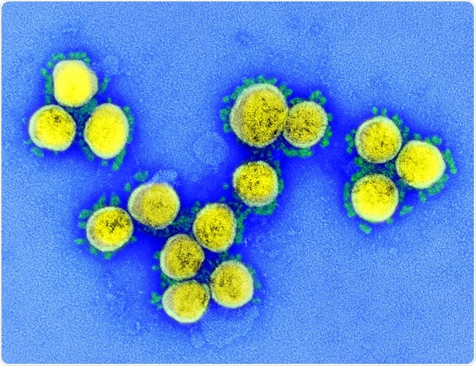 Novel Coronavirus SARS-CoV-2: This scanning electron microscope image shows SARS-CoV-2 (round gold objects) emerging from the surface of cells cultured in the lab.  Credit: NIAID-RML