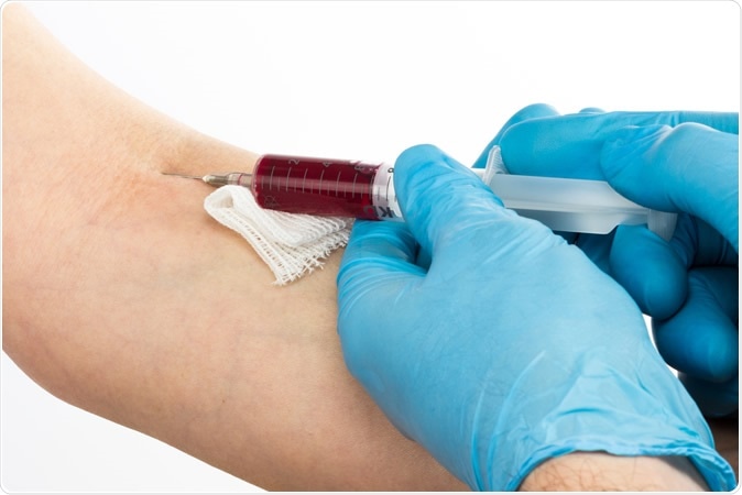 news medical