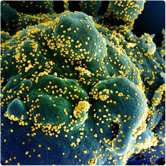 Novel Coronavirus SARS-CoV-2 Colorized scanning electron micrograph of an apoptotic cell (blue/green) heavily infected with SARS-COV-2 virus particles (yellow), isolated from a patient sample. Image captured at the NIAID Integrated Research Facility (IRF) in Fort Detrick, Maryland. Credit: NIAID