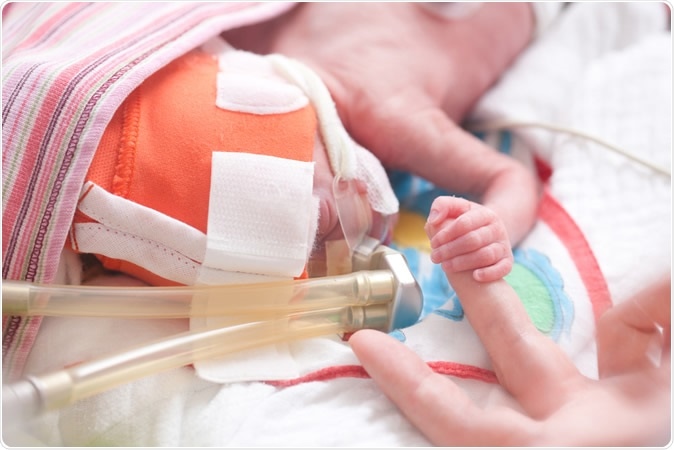 Academic Outcomes of School-Aged Children Born Preterm A Systematic Review and Meta-analysis. Image Credit: cmp55 / Shutterstock