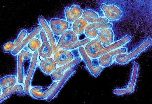 Az ebola mellett megjelent a Marburg-vírus is