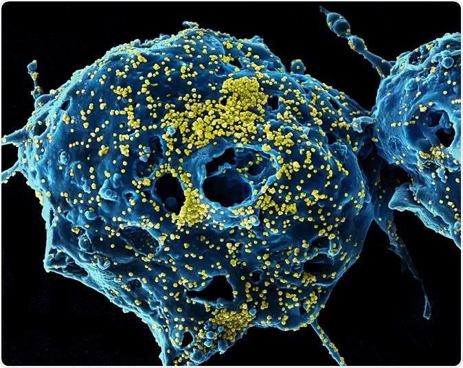MERS Virus Particles Colorized scanning electron micrograph of Middle East Respiratory Syndrome virus particles (yellow) attached to the surface of an infected VERO E6 cell (blue). Image captured and color-enhanced at the NIAID Integrated Research Facility in Fort Detrick, Maryland. Credit: NIAID