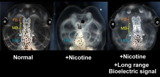 Nicotine induced defects in the frog embryo brain (center) can be rescued by transplanting an HCN2 expressing patch on the embryo far from the brain. Treated embryos are observed to have normal brain morphology and function (right). View of normal embryo head is shown at left. Similar results are seen when nicotine-exposed embryos are treated with ionoceutical drugs. (FB = forebrain; MB = midbrain; HB = hindbrain)  CREDIT Vaibhav Pai, Tufts University