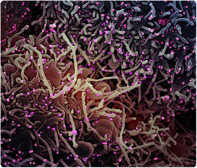 Novel Coronavirus SARS-CoV-2 Colorized scanning electron micrograph of a VERO E6 cell (purple) exhibiting elongated cell projections and signs of apoptosis, after infection with SARS-COV-2 virus particles (pink), which were isolated from a patient sample. Image captured at the NIAID Integrated Research Facility (IRF) in Fort Detrick, Maryland. Credit: NIAID