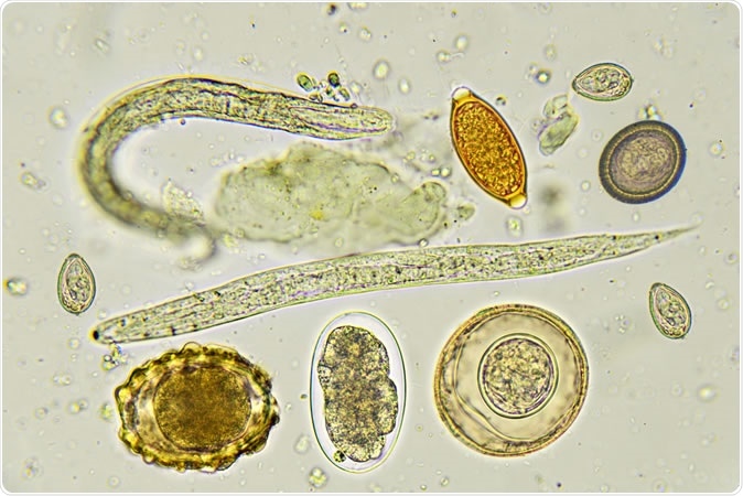 Do parasites protect against SARS CoV 2 