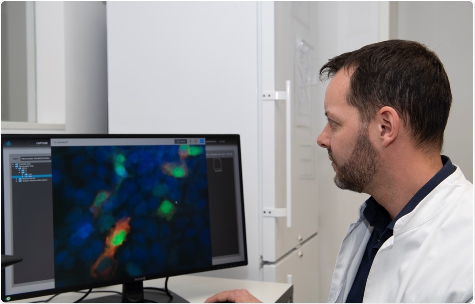 Pesquisadores identificam mecanismos gen�ticos que produzem radiorresist�ncia em c�lulas cancer�genas