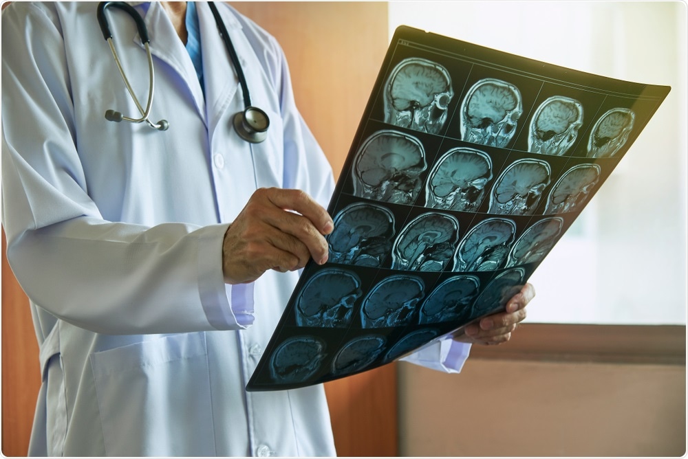 Study: Magnetic Resonance Imaging Alteration of the Brain in a Patient With Coronavirus Disease 2019 (COVID-19) and Anosmia. Image Credit: Teeradej / Shutterstock
