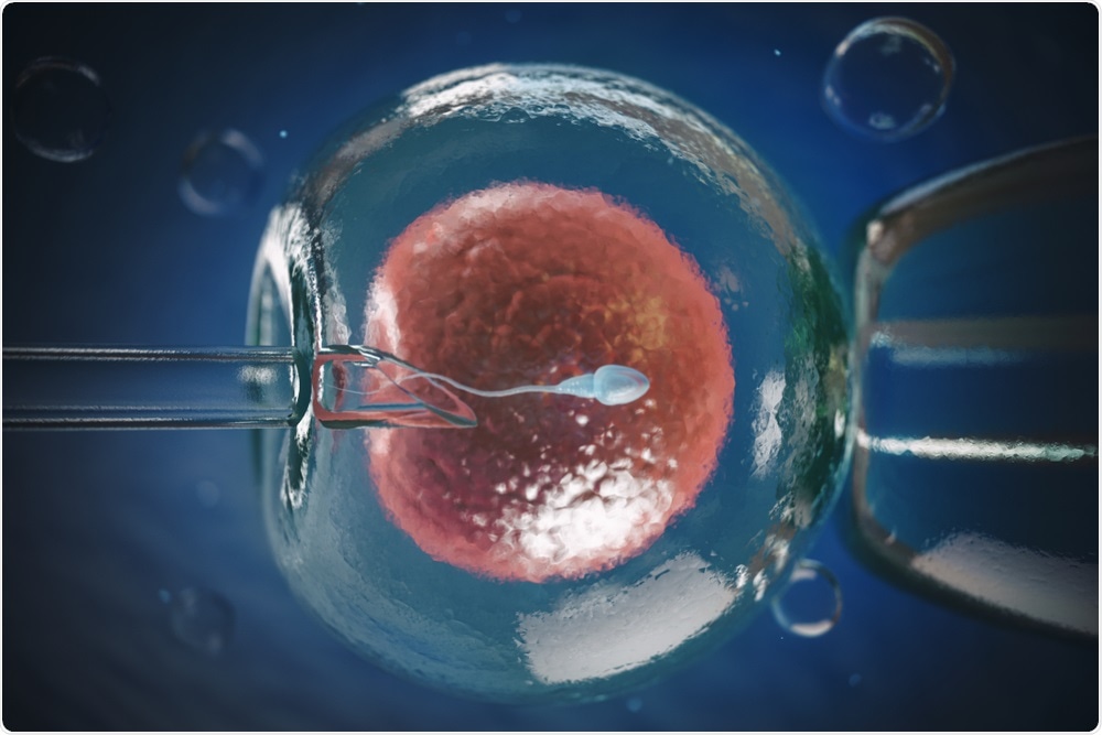 IVG An Improved Method Than IVF