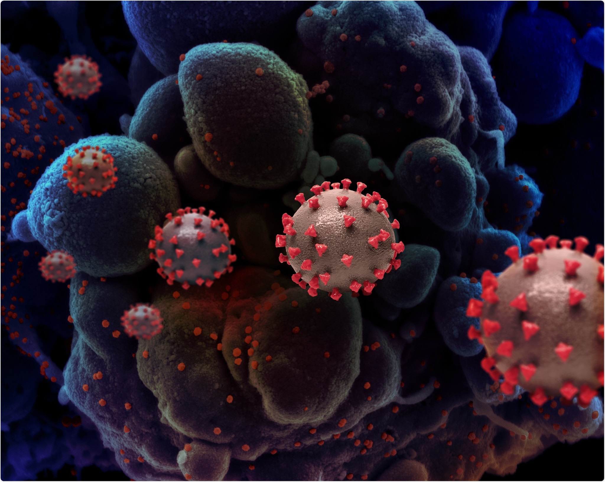 Novel Coronavirus SARS-CoV-2 Creative rendition of SARS-COV-2 virus particles. Note: not to scale. Credit: NIAID