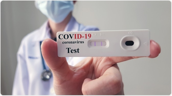 COVID-19 antibody testing