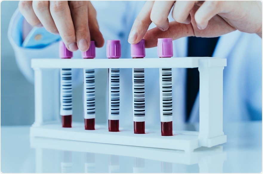 prostate cancer blood test nhs)