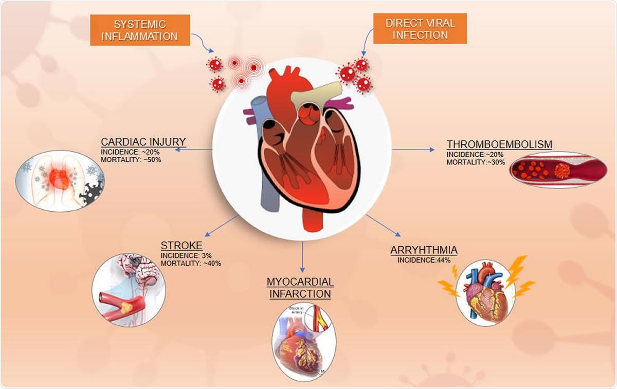 Cardiovascular disease in COVID-19