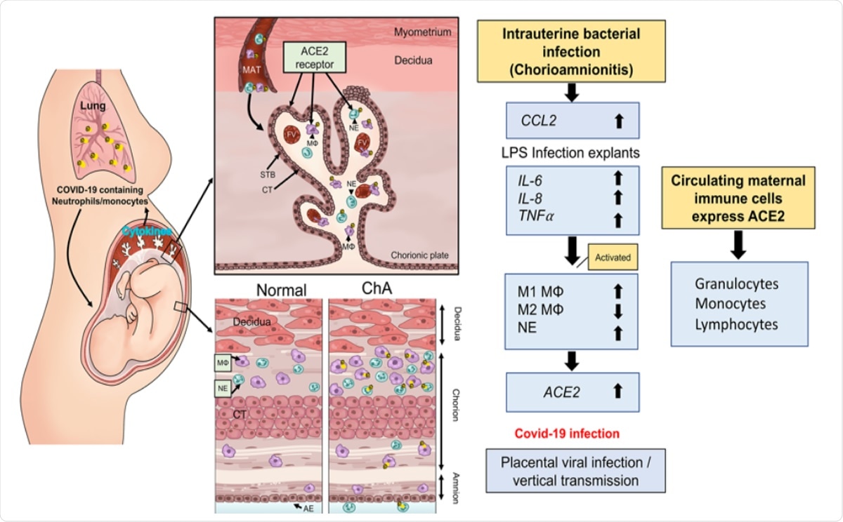 Maternal immune cells could bring SARS-CoV-2 to the placenta - News-Medical.Net