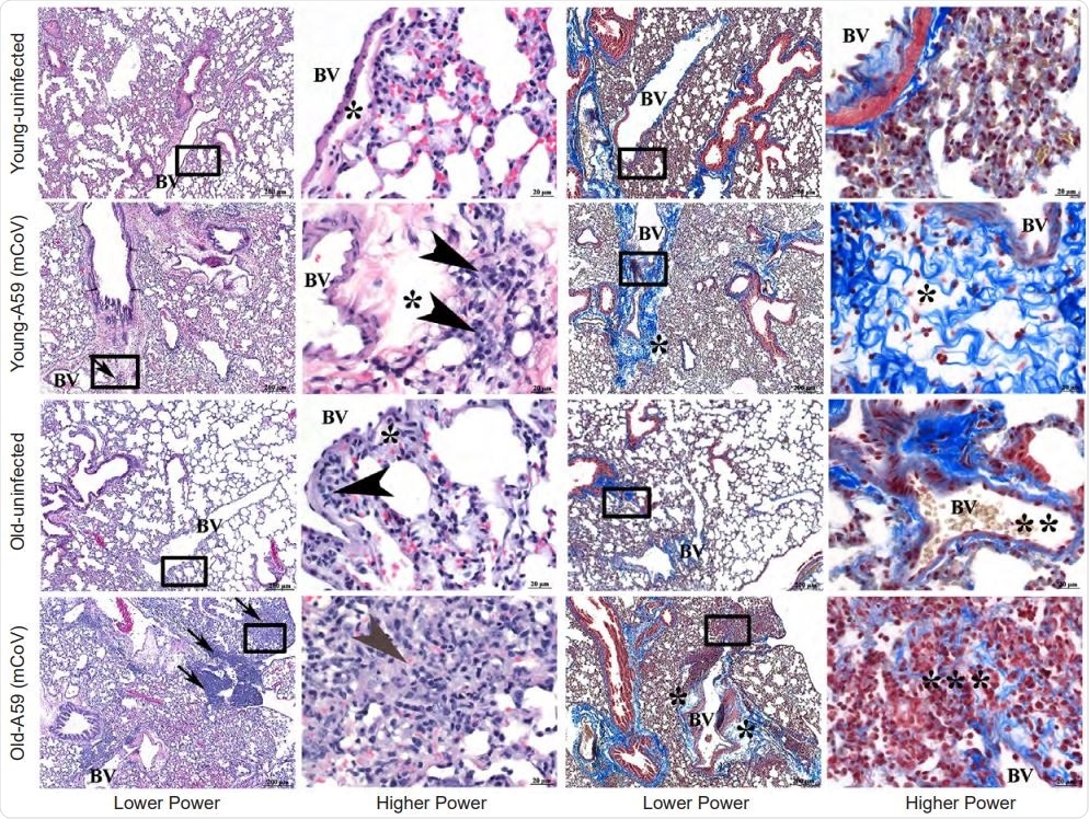 does ketogenic diet help infectio.