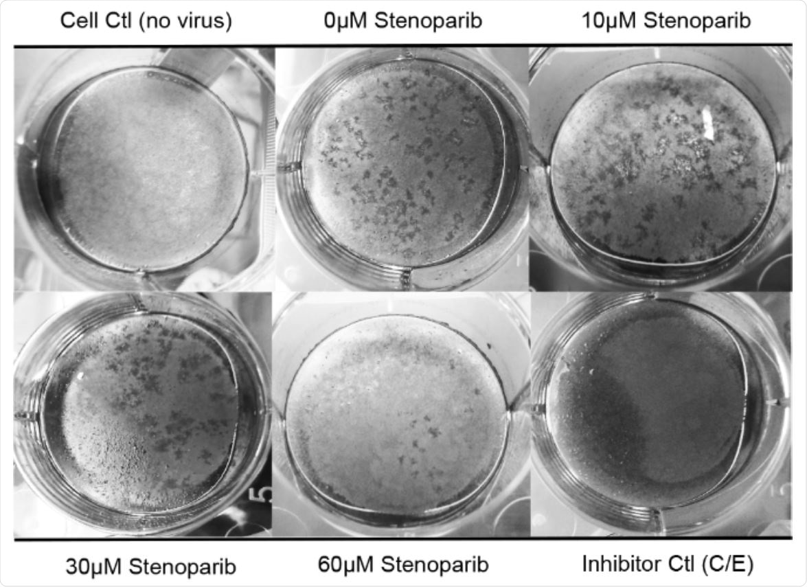 Stenoparib inhibits plaque formation in Calu-3 cells. The plaque assay was performed using Calu-3 cells infected with SARS-CoV-2 and treated with various concentrations of stenoparib. Plaques are identified as empty areas or 