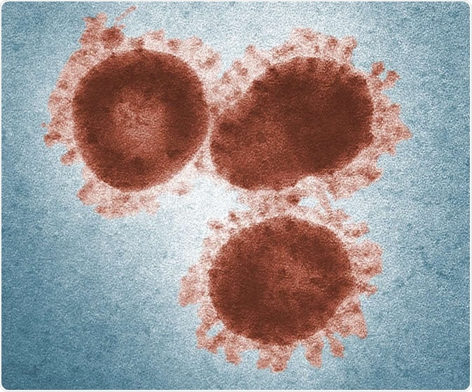 Coronaviruses (colored transmission electron microscopy image). Image Credit: Dr. Fred Murphy & Sylvia Whitfield/CDC