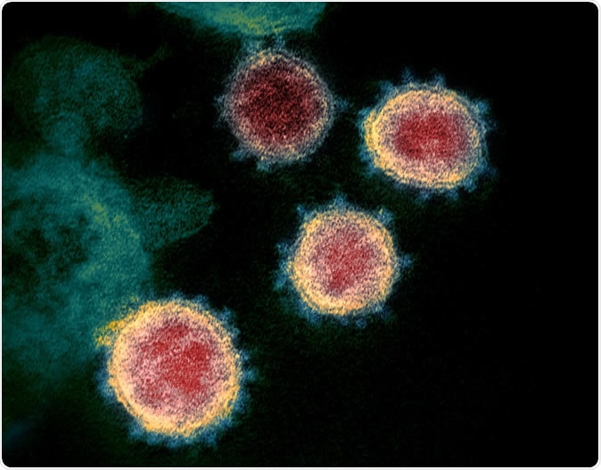 This transmission electron microscope image shows SARS-CoV-2—also known as 2019-nCoV, the virus that causes COVID-19—isolated from a patient in the U.S. Virus particles are shown emerging from the surface of cells cultured in the lab. The spikes on the outer edge of the virus particles give coronaviruses their name, crown-like. Credit: NIAID-RML