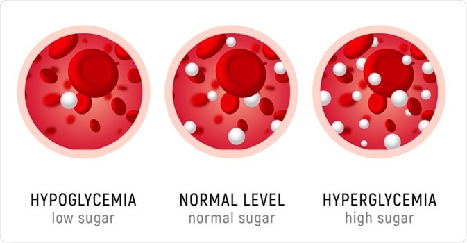 Diabetes insulin hypoglycemia or hyperglycemia diagram. Image Credit: Kolonko / Shutterstock