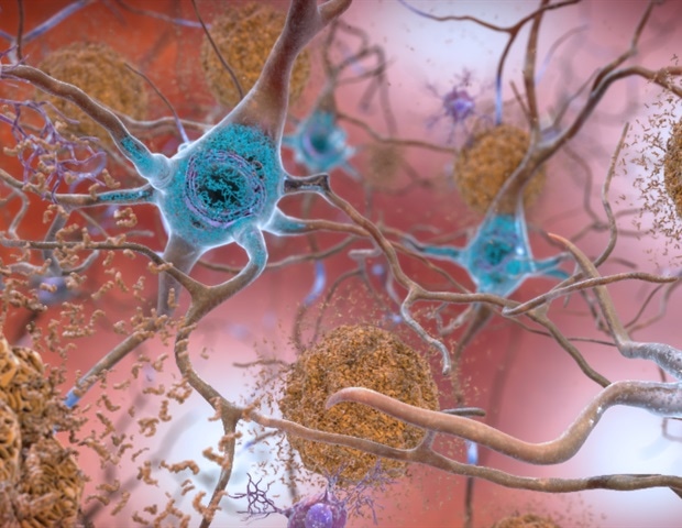 Scientists develop an mRNA technology approach to target Alzheimer’s disease