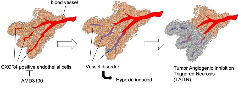 Damaging the tumor blood vessels could be new strategy to treat oral cancer