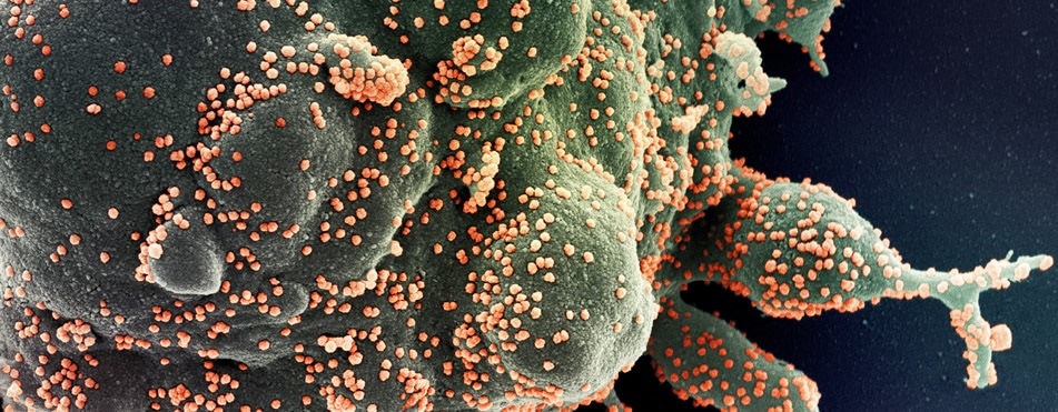 COVID-19 and renin-angiotensin system inhibitors