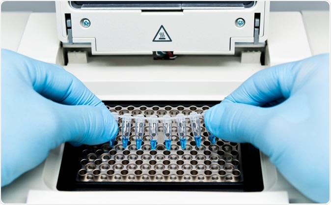 A pool of samples for testing SARS-CoV-2 in asymptomatic individuals. Image credit: unoL / Shutterstock
