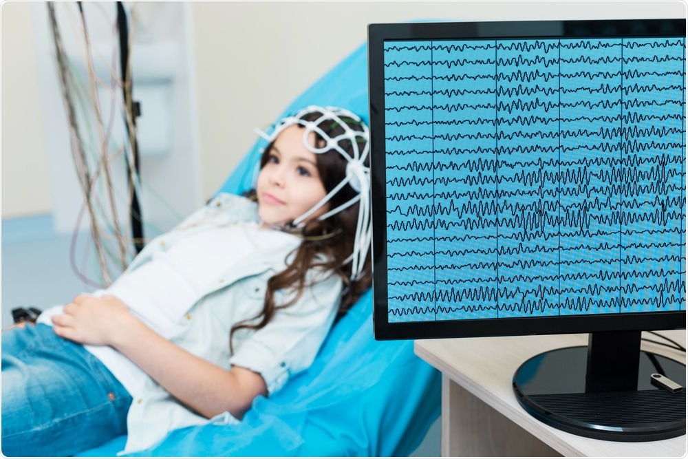 EEG Scan