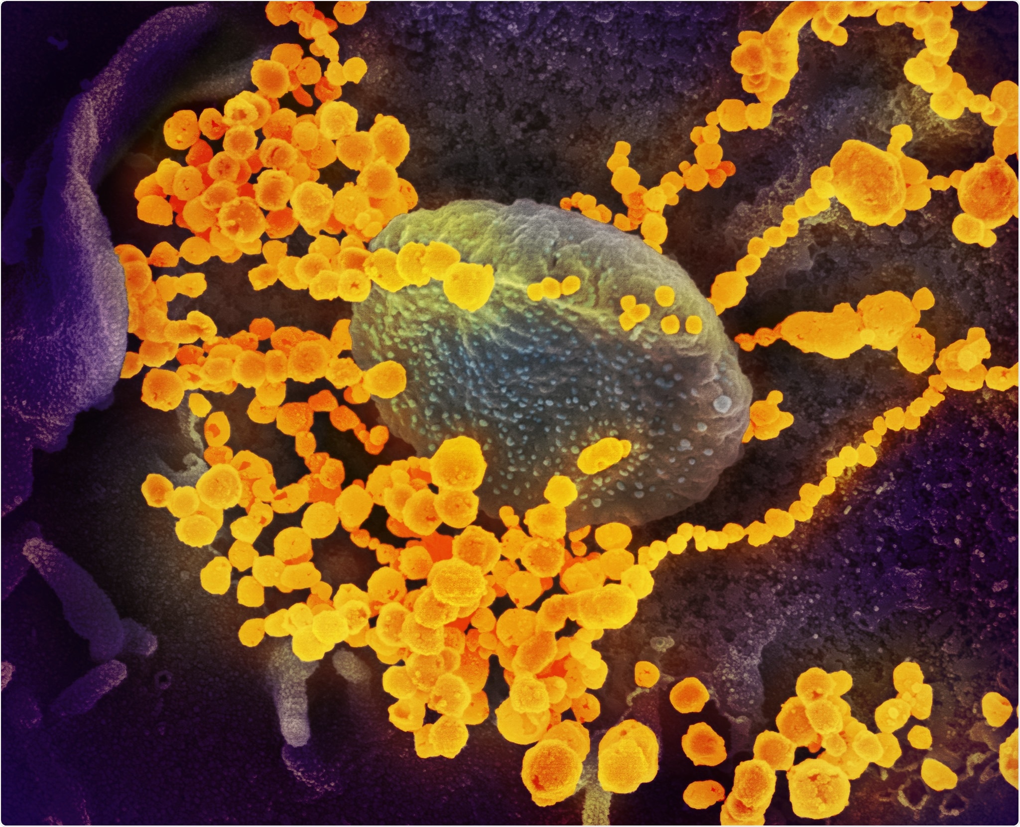 Novel Coronavirus SARS-CoV-2 This scanning electron microscope image shows SARS-CoV-2 (round gold objects) emerging from the surface of cells cultured in the lab. SARS-CoV-2, also known as 2019-nCoV, is the virus that causes COVID-19. The virus shown was isolated from a patient in the U.S. Image captured and colorized at NIAID