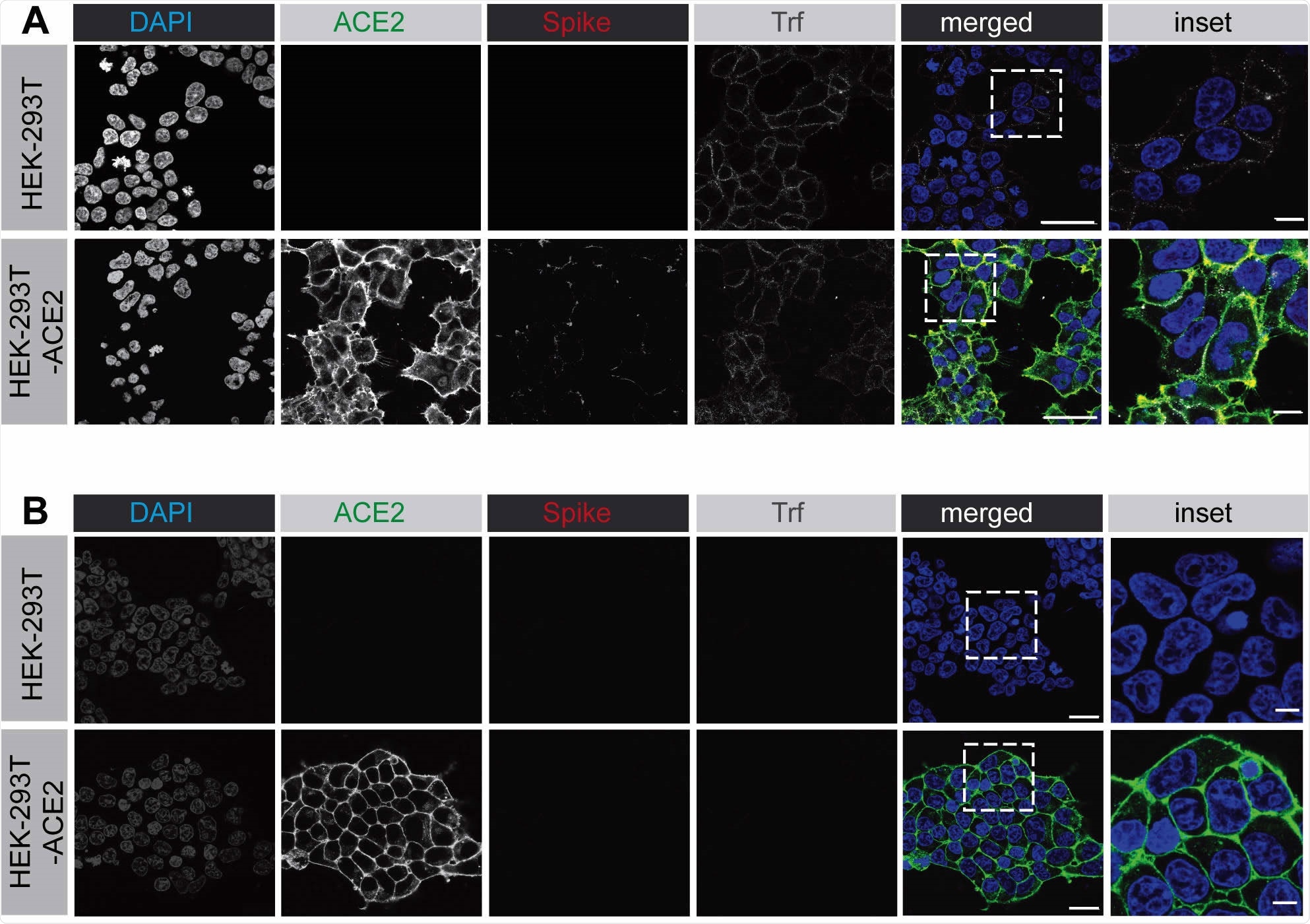 The SARS-CoV-2 spike protein binds to the surface of HEK-293 cells expressing ACE2.  (A) HEK-293 cells, wild-type (top row of image) or stable expression of ACE2 (bottom row of image), purified His6-tagged spike protein and alexa-647 labeled transferrin at 4°. After incubating for 30 minutes in C. After washing with PBS, cells were fixed and stained with DAPI to reveal nuclei, the antibody selectively recognized ACE2, and the antibody recognized the spike protein His6 epitope tag.  The scale bar is 40 µm for low magnification images and 10 µm for high magnification insets.  (B) An experiment carried out in the same manner as in A, except that HEK-293 cells were briefly washed with acid before fixation.  The scale bar is 40 µm for low magnification images and 10 µm for high magnification insets.