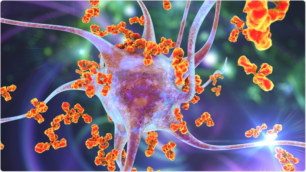 Study: Auto-antibodies against type I IFNs in patients with life-threatening COVID-19. Image Credit: Kateryna Kon / Shutterstock
