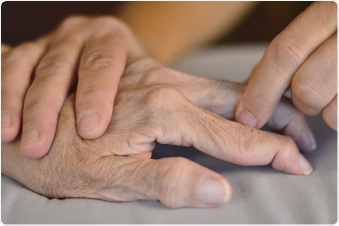 Rheumatoid arthritis otthoni kezelése