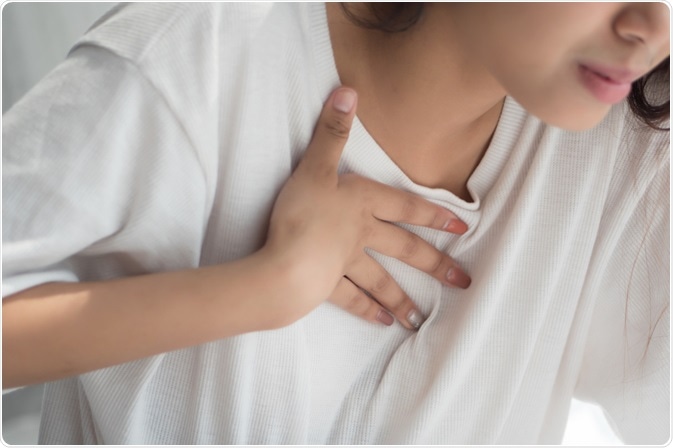 Heartburn (Acid Reflux) Treatments