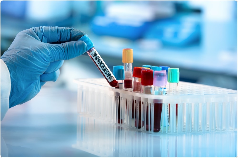 How the new In-Vitro Diagnostics Regulations are affecting the life sciences landscape