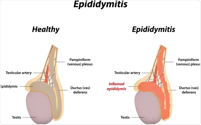 Of one testicle only side having effects Weird Facts