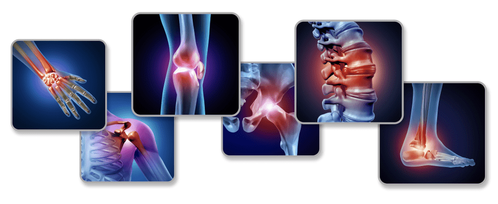 osteoarthritis treatment 2021 kenőcs a láb ízületének gyulladásáért