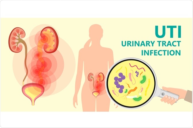 Urinary Tract Infection Prevention