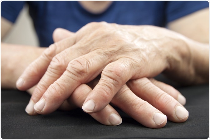 Self-Help and Living with Rheumatoid Arthritis