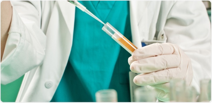 prostate cancer test urine