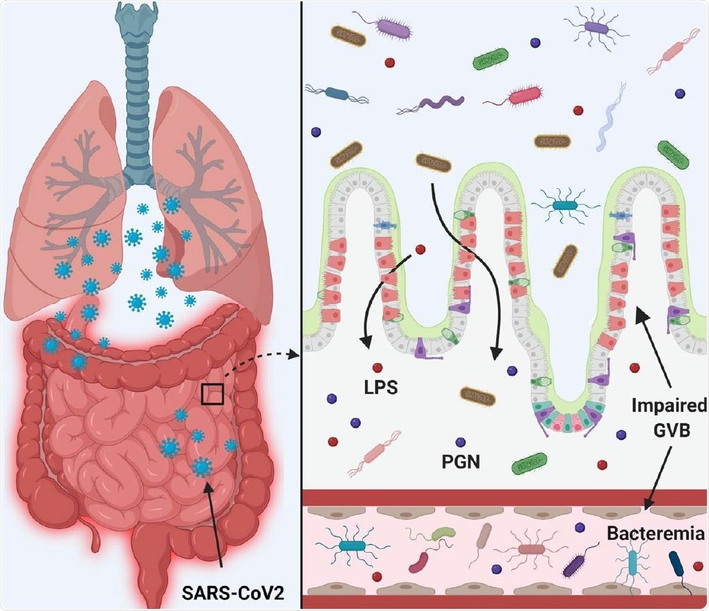 dysbiosis and leaky gut