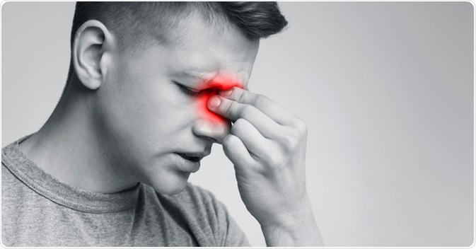 What Is Sinus Headache