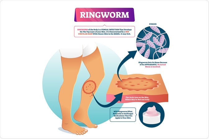 how do you know ringworm is healing in dogs