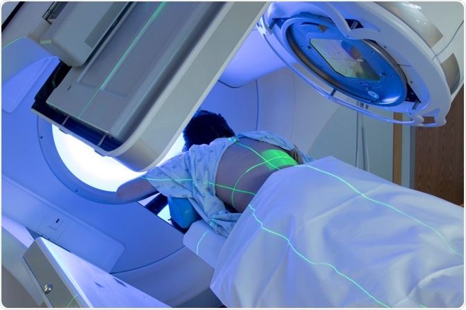 Radiation Therapy Types